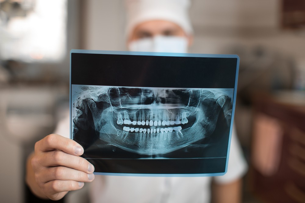 radiografie dentară București
