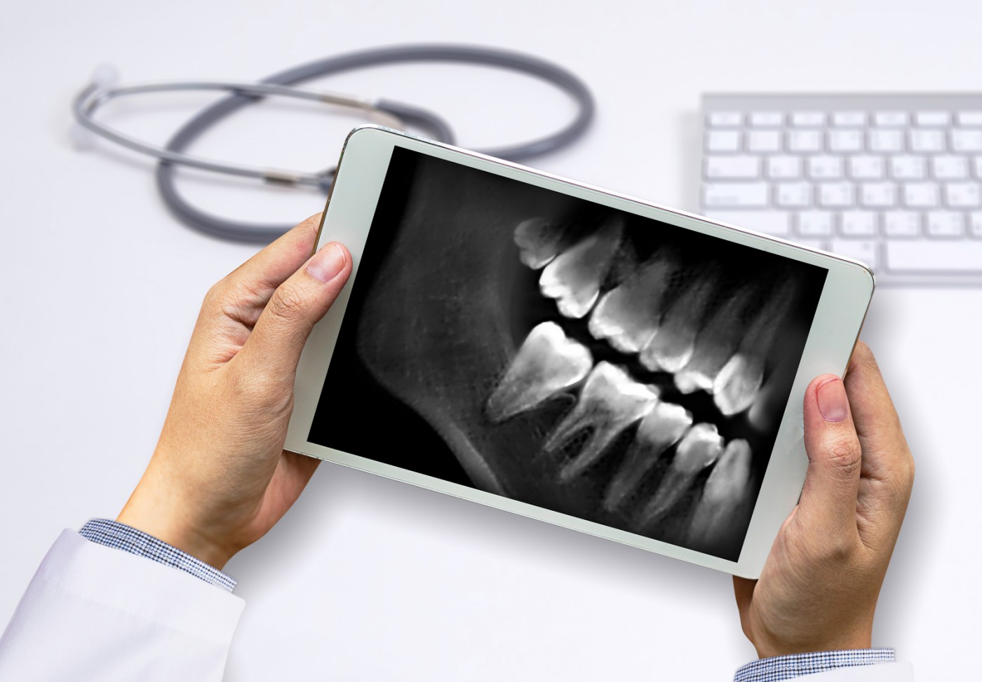 Radiografia dentară digitală prezintă riscuri?