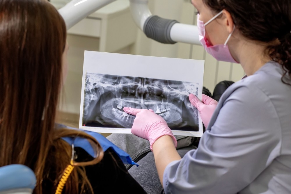 radiografie panoramica, tomografii, radiografi partiale, radiografie entară, yts dental view