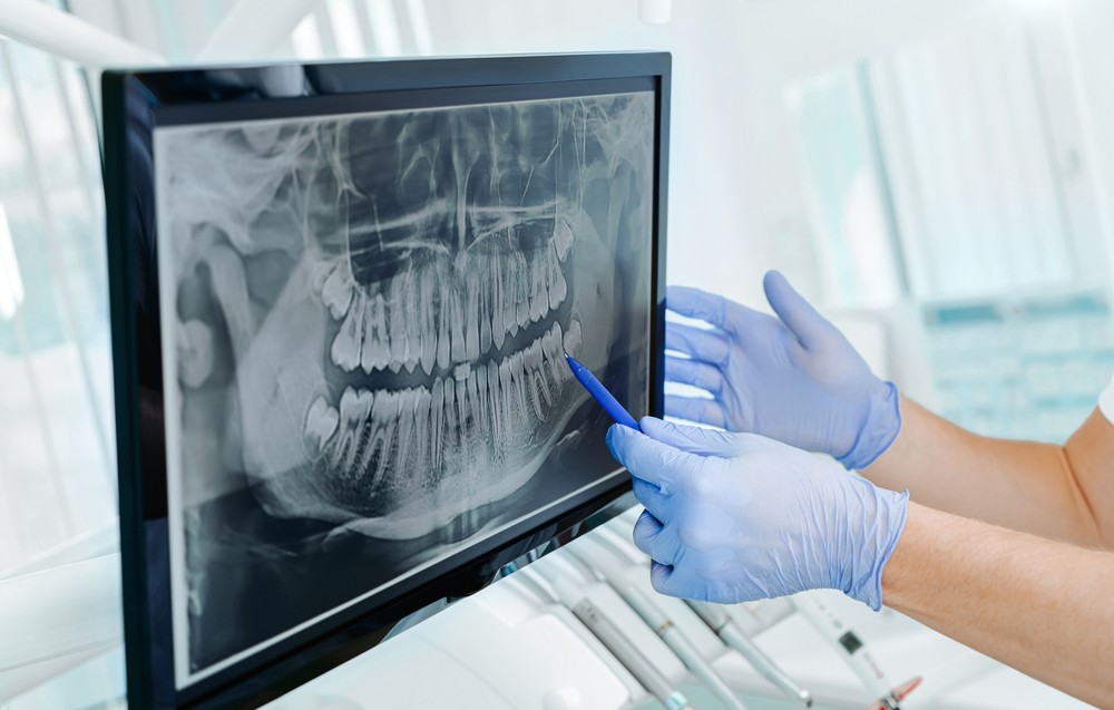 radiografie dentară 3D preț