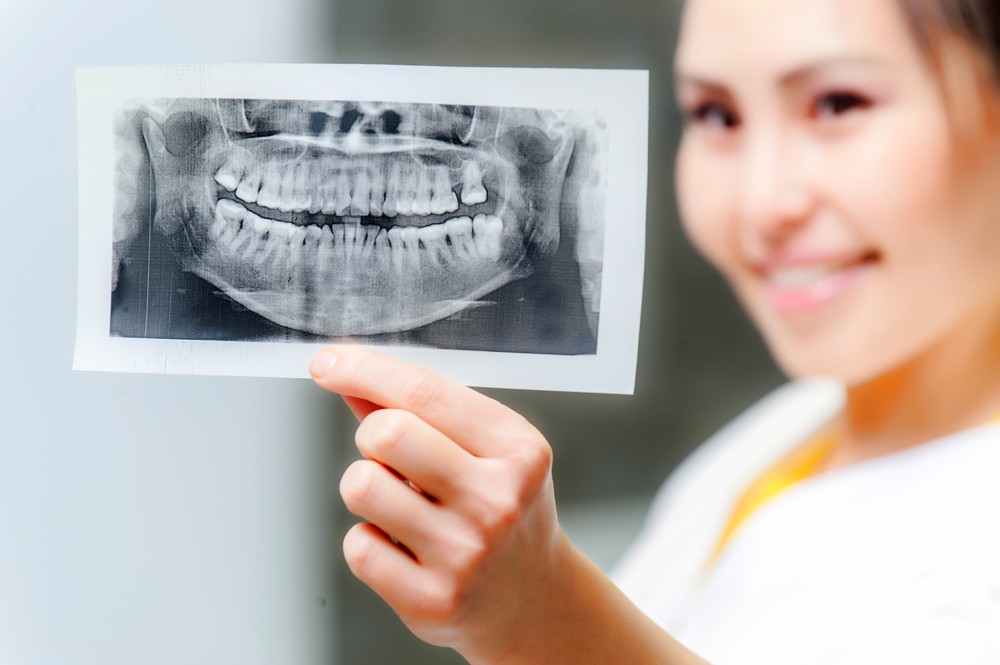 radiografie dentara panoramica digitala, yts dental view, radiografie dentara