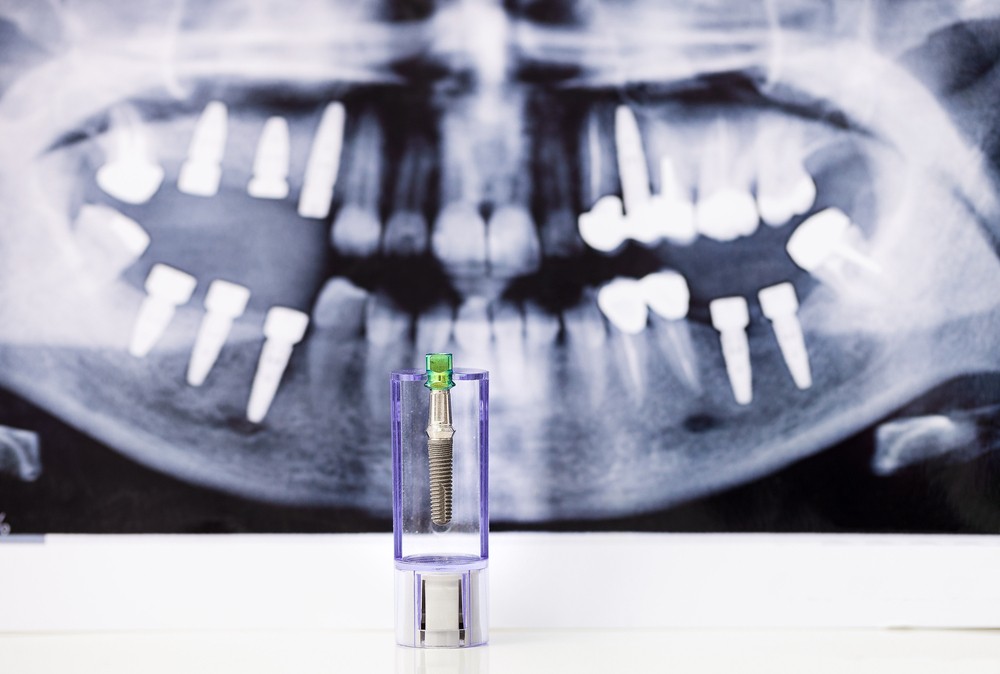 radiografie dentara bucuresti, tomografie dentara bucuresti, yts dental view