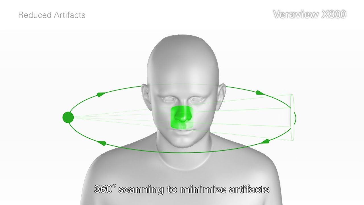Tomografie dentară cu fascicul conic în București