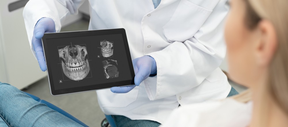 radiografie dentara bucuresti, tomografie dentara bucurești, yts dental view bucuresti