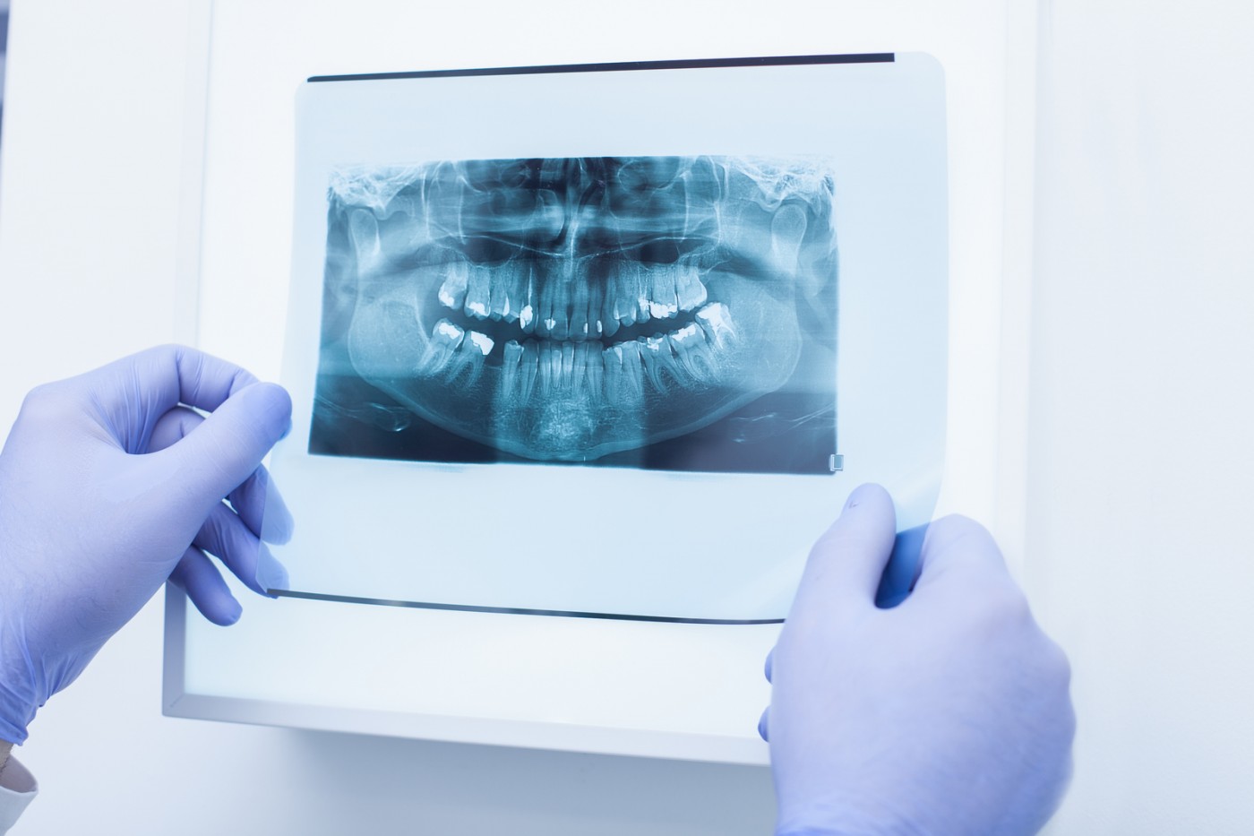 Razele X sunt sigure?